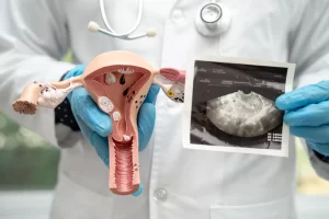 IVF Success Rate: What Affects Your Chances? | Lavanya Fertility