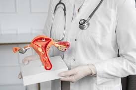Gynecological Surgeries